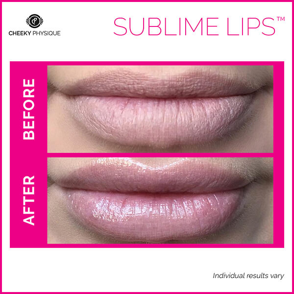 sublime lips before after
