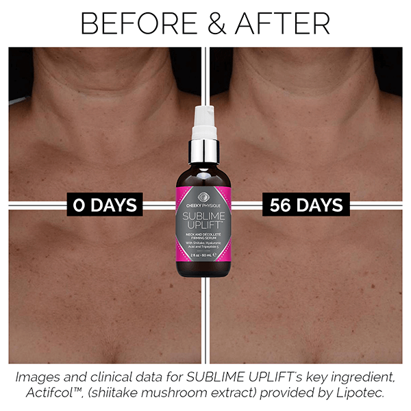 sublime uplift before after