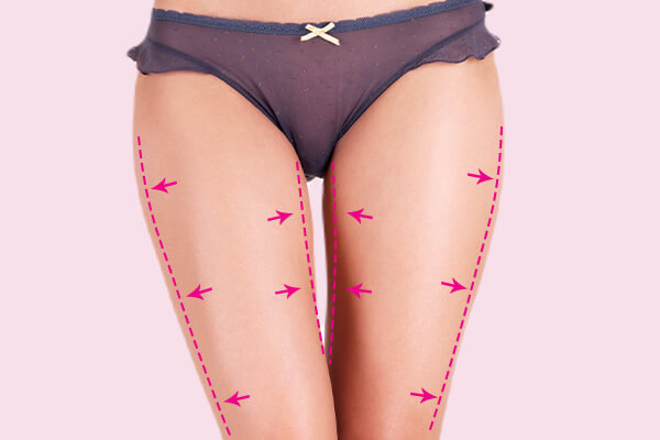 thigh diagram