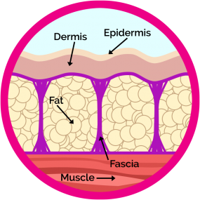 cellulite Cellulite